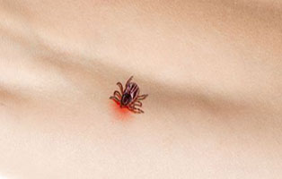 Long Island Tick & Mosquito Spraying