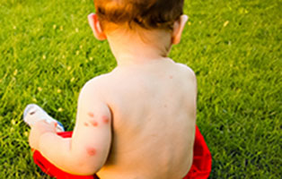 Long Island Tick & Mosquito Spraying