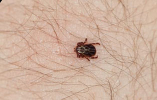 Long Island Tick & Mosquito Spraying